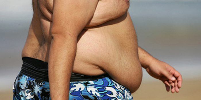 ¿Qué se entiende por obesidad mórbida?