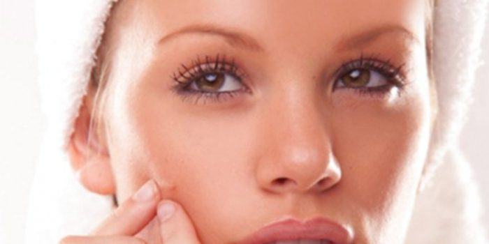 Consejos para saber como eliminar marcas de acné